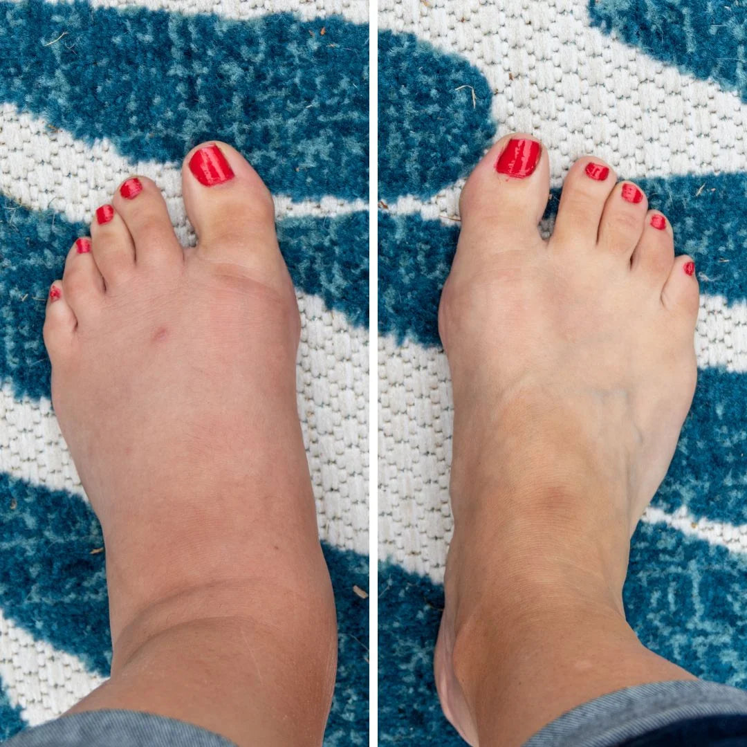 Livsförändrande resultat